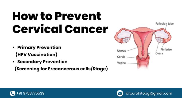 How to Prevent Cervical Cancer